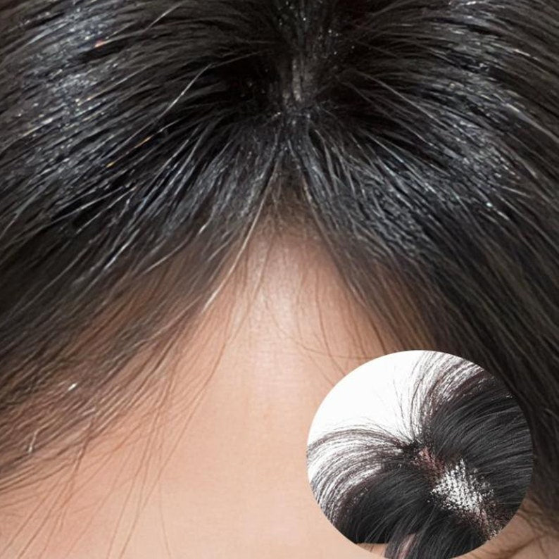 Daphné ︳Topper de cheveux humains avec frange pour cheveux fins, base en dentelle 6*9CM