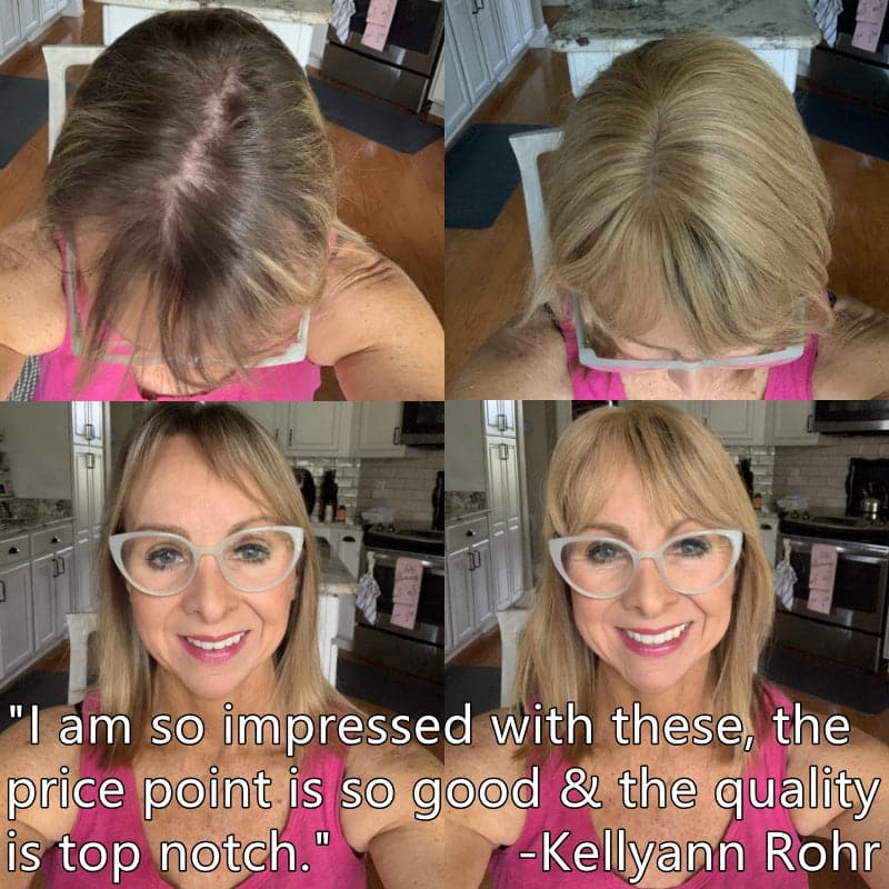 Daisy ︳Human Hair Topper With Bang For Women Thinning Crown 6*9cm Silk Base Bronde Highlight E-LITCHI