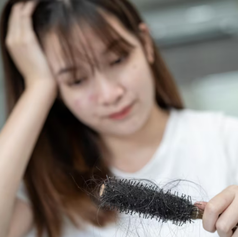 Everything About Teenage Hair Loss:  Causes & Treatment