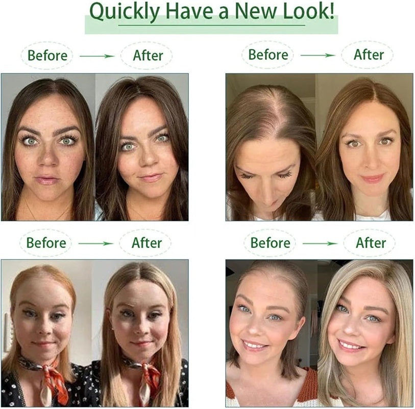 Invisible Human Hair Topper 7*10cm Base 10–18 Inch Natural Look