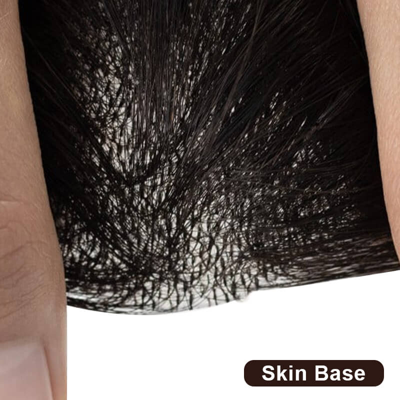 skin hair patches
