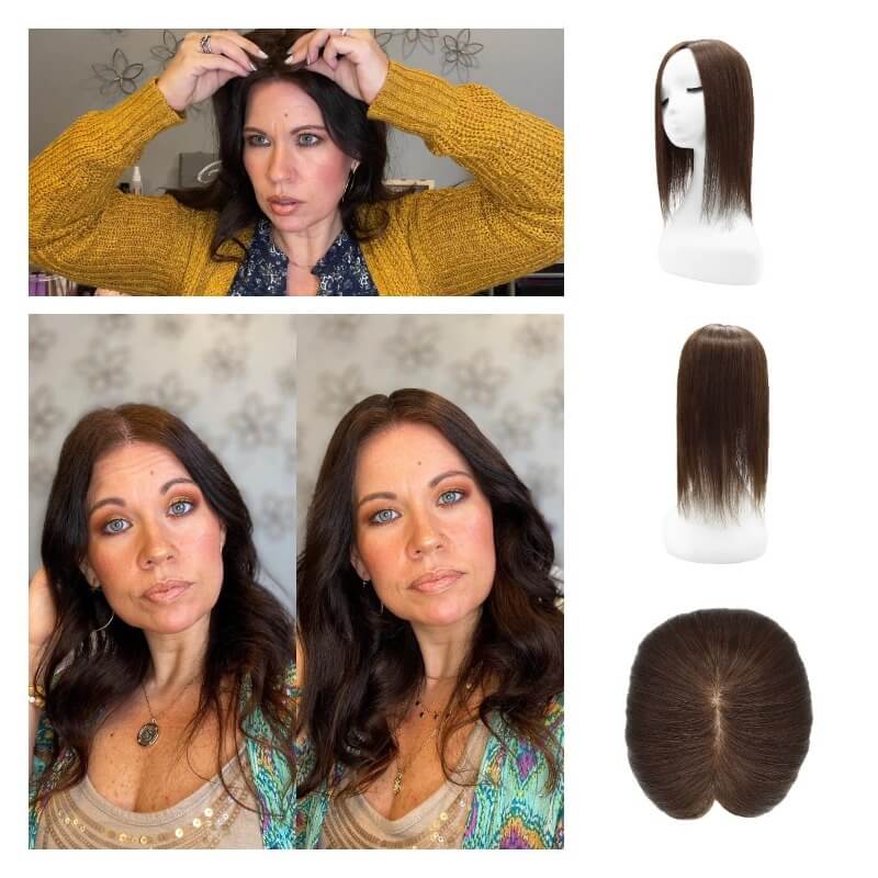 hair topper for thinning hair