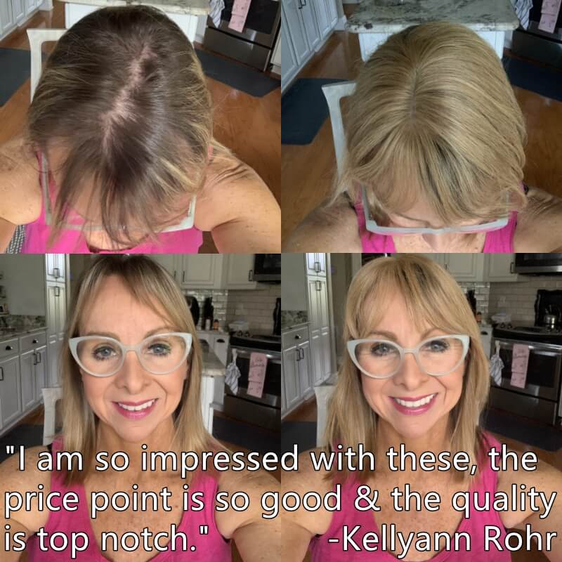 hair topper for thinning crown
